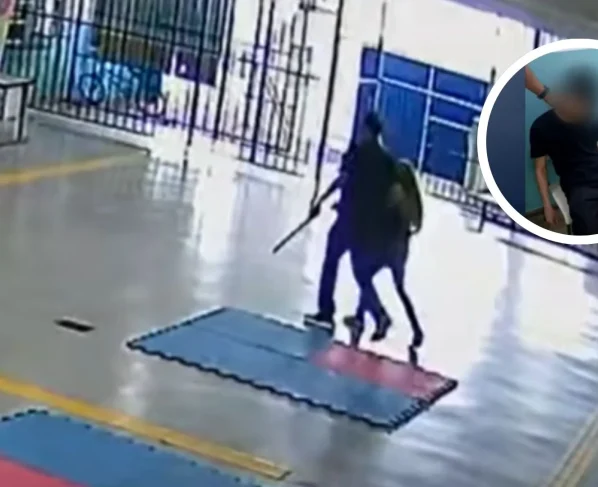 Professora ferida por ex-aluno em ataque a escola perde dedo da mão – Imagem: reproduçã/ SBT