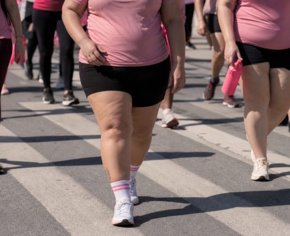 Caminhadas buscam conscientizar população sobre lipedema