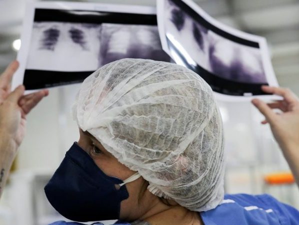 Diagnóstico tardio dá poucas chances de cura para o câncer de pulmão