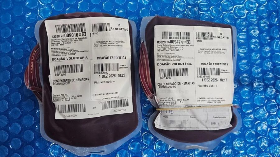 Para atender paciente com anemia falciforme, SC recebe bolsas de sangue raro; entenda o que é
